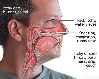 Health concerns due to mold exposure.